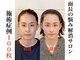 小顔22 ボルティ 赤坂支店(Bolty)の写真
