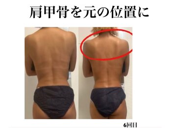 オーシャンブルーム 目黒(OceanBloom)/ハイパーナイフ×肩甲骨剥がし