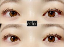 エクラ(eclat)