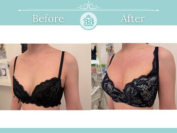 美人バスト 渋谷店/【バストアップ・育乳】◇症例◇