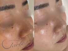 サロン ド クラルテ(salon de clarte)の雰囲気(お肌のお悩みに合わせてトリートメントを行います♪)