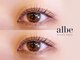 アルベ(albe)の写真
