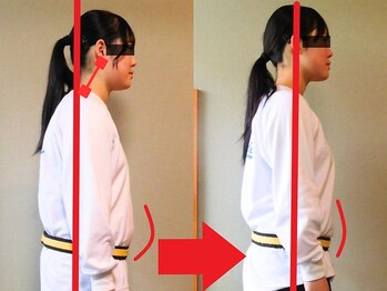 チャラク(charaku)/【10代O様：猫背＋反り腰矯正】