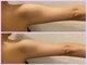 美肌痩身サロン ラエルヴェ(La Elever)の写真