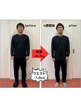 たかみや鍼灸接骨院/耳つぼ＋食事調整でダイエット