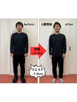 たかみや鍼灸接骨院/耳つぼ＋食事調整でダイエット