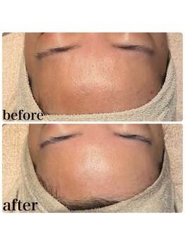 ディオーネ 春日井勝川店(Dione)/マーメイドセルトリートメント