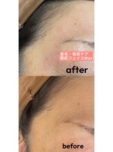 デフィ(Defi)/おでこWax♪生え際も綺麗に！