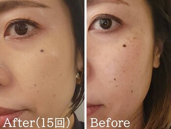 ココモンド(COCOMONDO)/セルマン艶肌ピーリング