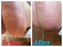 ルナネイル(LUNA NAIL)/角質ケア