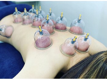 プロムナード(PROMENADE)/カッピング中