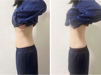 サンク(Cinq)/【整体+骨盤矯正】反り腰改善