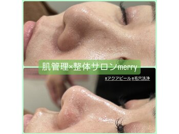 メリー(merry)/アクアピール/毛穴洗浄