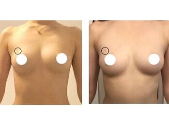 エスビューティー 三軒茶屋(S beauty)/バストケア・池尻大橋・痩身