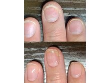 アカツキネイル(Akatsuki Nail)