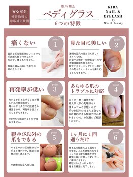 キラネイル アンド アイラッシュ by World Beauty(KIRA)/巻爪補正 新潟巻爪
