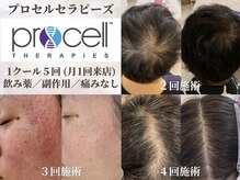 まどろみ(madoromi)の雰囲気（【肌／髪悩み】話題のヒト幹細胞施術◎世界的実績と確かな改善）