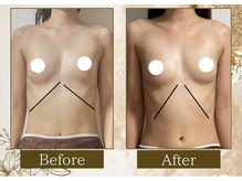 マリン(MARINE)/Before→After