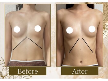 マリン(MARINE)/Before→After