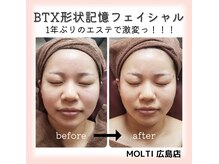 モルティー 広島店(Molti)/1年ぶりのエステで激変