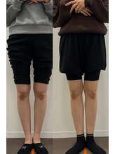 なおちゃん整骨院 整体院/O脚矯正ビフォーアフター前