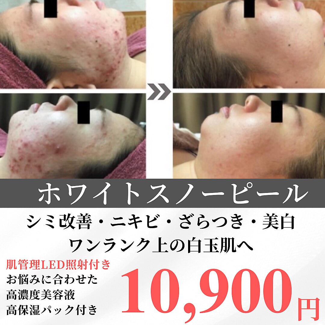 キレナル(KIRENAL)｜ホットペッパービューティー