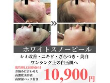 キレナル(KIRENAL)