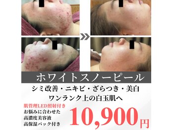 キレナル(KIRENAL)