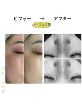 オリエンス(oriens)/肌代謝を3日に！