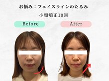 美容整体 ウェリナ 蟹江院/小顔矯正/骨盤矯正/痩身整体