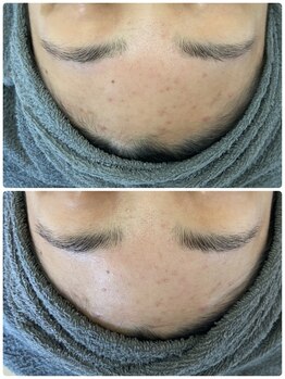 サロンドール(SalonDoll)/