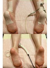 ビサンテ サロン/角質育成ケア・足裏,踵ガサガサ