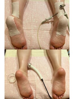 角質育成ケア・足裏,踵ガサガサ