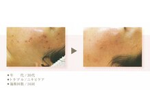 デジール/【エステ初心者】にオススメ☆