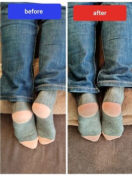 ユープラス(YOU PLUS)/整体before/after