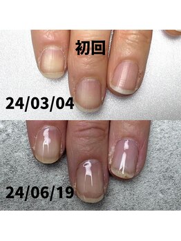 乾燥あった指周りも変化あり♪