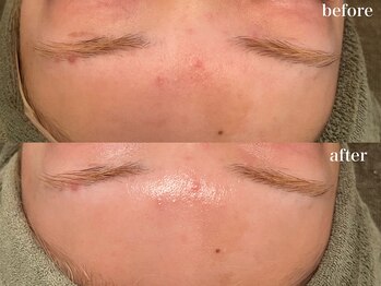 リボーン 浜松(reborn)/