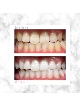 ホワイト 上乃木南店(WHITE)/ビフォーアフター