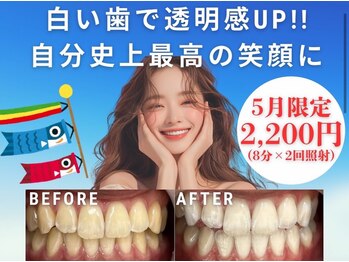 LBSホワイトニング 銀座店