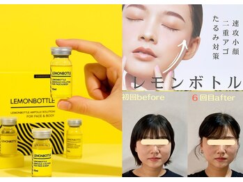 エスポワール(espoir)