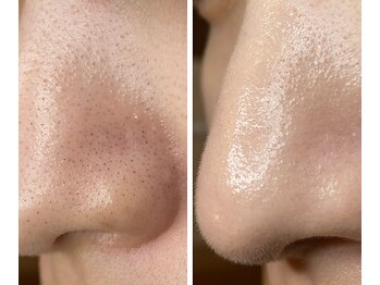 サイ(Sai)/before⇒after