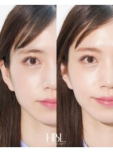 ミーククル(MEKUKURU)/眉毛-ハリウッドブロウリフト-