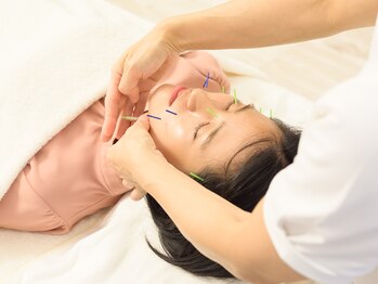 ハリ ヴァカンス(Hari Vacances)/痛みの少ない美容鍼で小顔