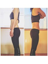 えみ整体院/夏までに本気で痩せたい方へ！