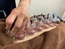 やす鍼灸院/施術　