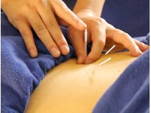 本厚木 リターナル(ReTurnal)/鍼/腰痛