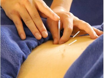 本厚木 リターナル(ReTurnal)/鍼/腰痛