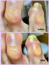 ラヴィ(La vie)/ずっと悩みでした