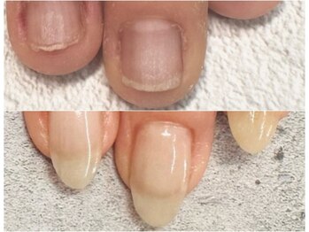 グレースレディ/いつでも相談できる！