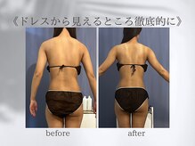 ジュプン 長崎/ブライダルエステ